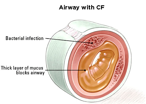 photo airway
