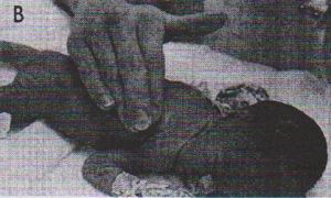 روش ضربه زدن در نوزادان با دو انگشت اشاره و وسط